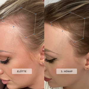 Elle Exclusive Duo